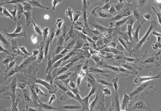 Huh-7-GFP 人肝癌-绿色标记