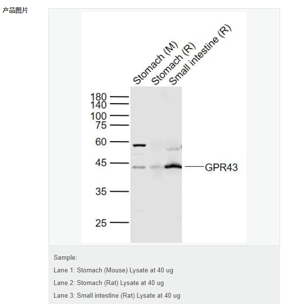 G蛋白偶联受体43抗体