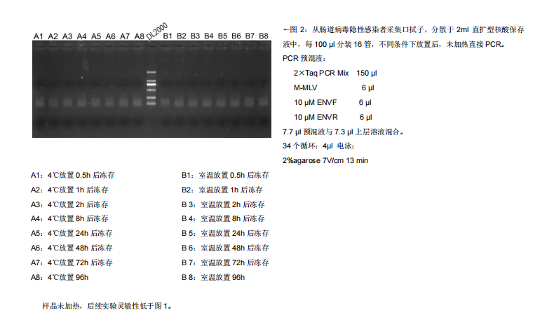 直扩型核酸保存液