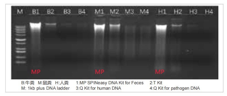 What??明明是同一个粪便,为什么他提取的 DNA的纯度总比我高?