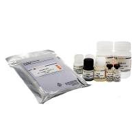 Human TIMP-1 ELISA Kit