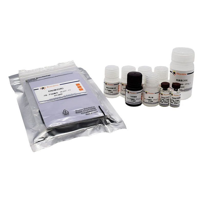 Human Pentraxin 3/TSG-14  ELISA Kit