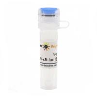 pNFκB-luc (报告基因质粒)