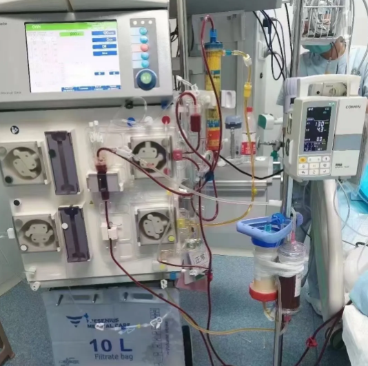 被蚊子叮、吃凉西瓜住进 ICU， 西安大兴医院这项人工救命技术绝了