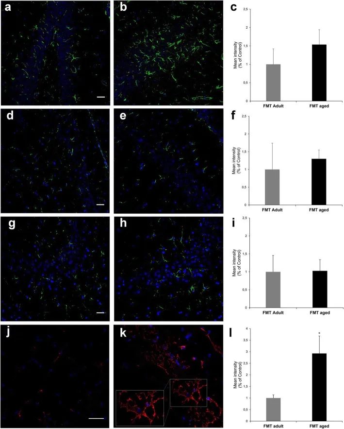 返老还童新选择,从小鼠粪便移植实验看到的趋势