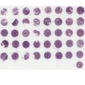 Dc Ova01042 卵巢多病理类型肿瘤组织组合芯片 附生存期信息 病理分级 Tnm和临床分期 Ajcc 8 0 20例 40点 1 5mm 价格 厂家 供应商 陕西爱维拉生物科技有限公司 丁香通