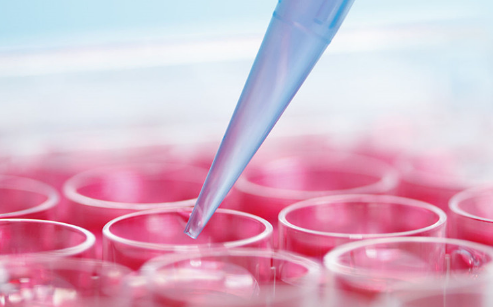 elisa实验常见的九种样品制备方法