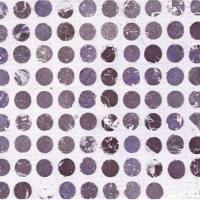 石蜡组织芯片技术