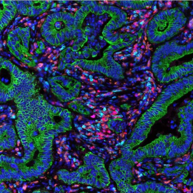 多重荧光免疫组化TSA技术