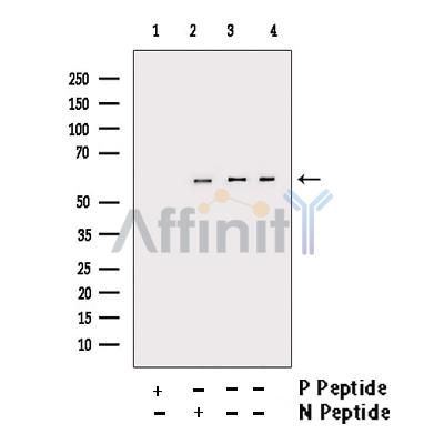 phospho-pan-AKT1/2/3 (Ser473) Antibody 