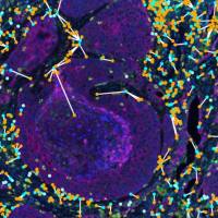 肿瘤微环境研究