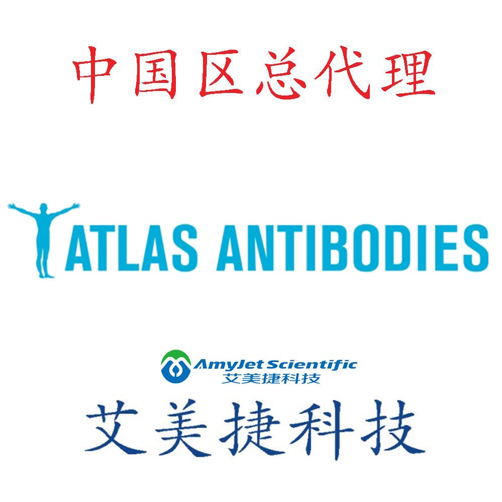 ALB抗体/Anti-ALB antibody