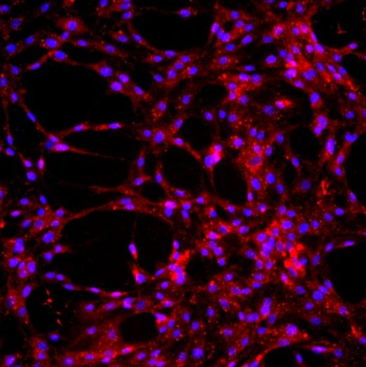 大鼠肺大动脉内皮细胞原代