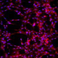 大鼠肺大动脉内皮细胞原代