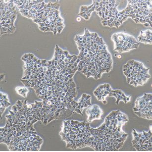 人乳腺导管癌细胞BT474