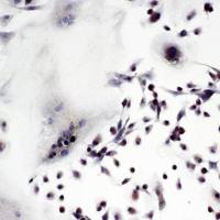 大鼠破骨细胞原代