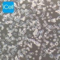 MDA-MB-436 人乳腺癌细胞/STR鉴定/镜像绮点（Cellverse）