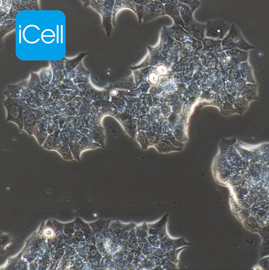 BT474 人乳腺导管癌细胞/STR鉴定/镜像绮点（Cellverse）