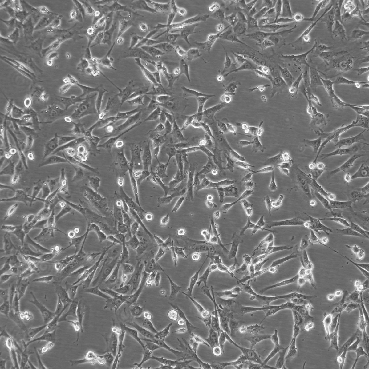 3T3-L1小鼠胚胎纤维母细胞