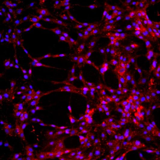小鼠骨髓来源内皮祖细胞原代