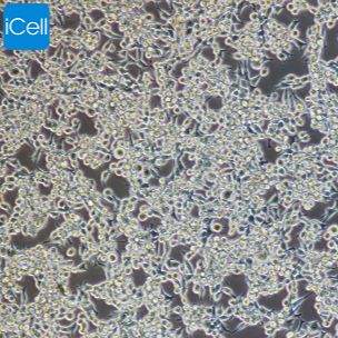 U14 小鼠子宫颈癌细胞 STR鉴定 镜像绮点（Cellverse）
