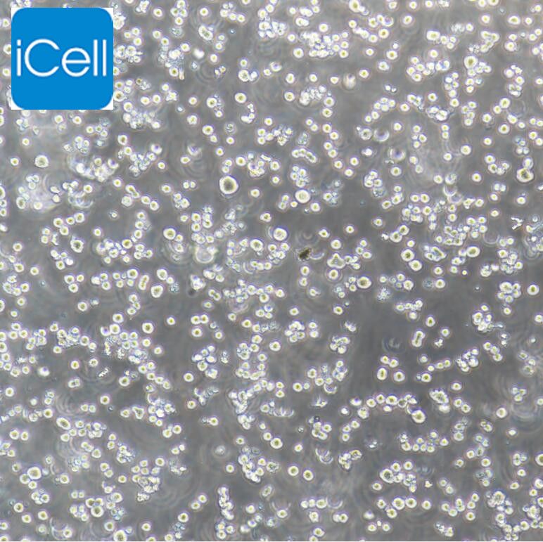 RPMI-8226 人多发性骨髓瘤外周血B淋巴细胞/STR鉴定/镜像绮点（Cellverse）