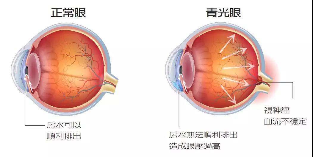 兩眼冒青光