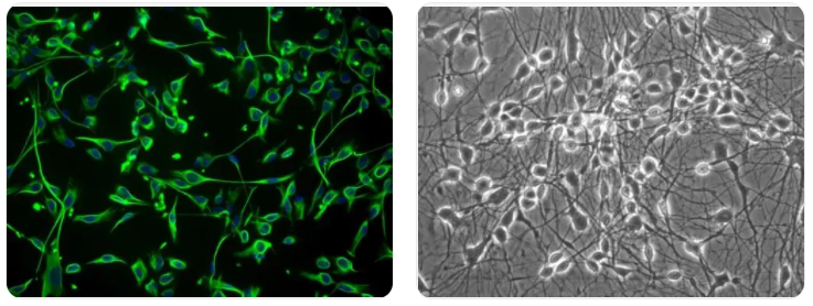 小鼠肝窦内皮细胞小鼠肝窦内皮细胞小鼠肝窦内皮细胞