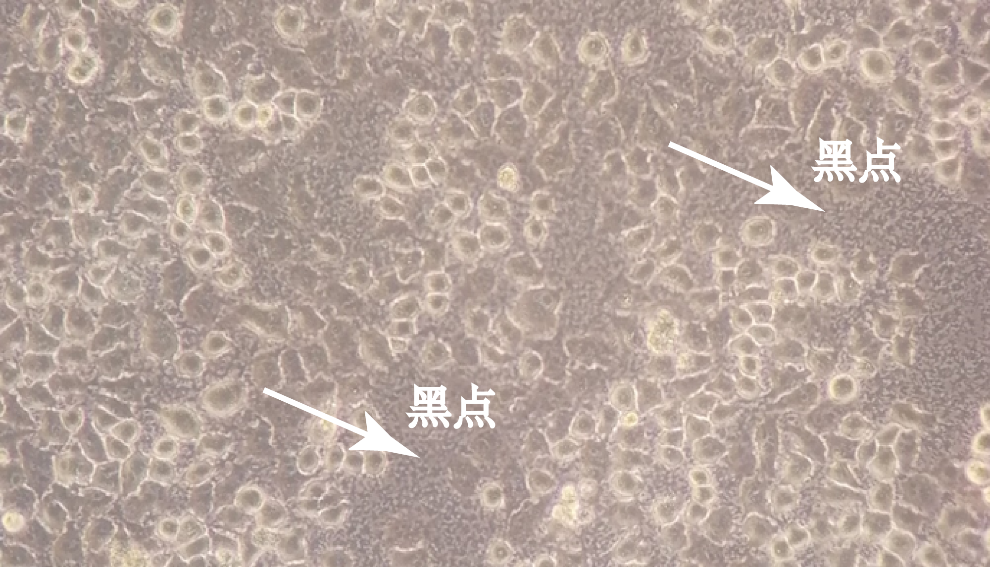 A875 人黑色素瘤细胞-原代细胞-STR细胞-细胞培养基-赛百慷生物