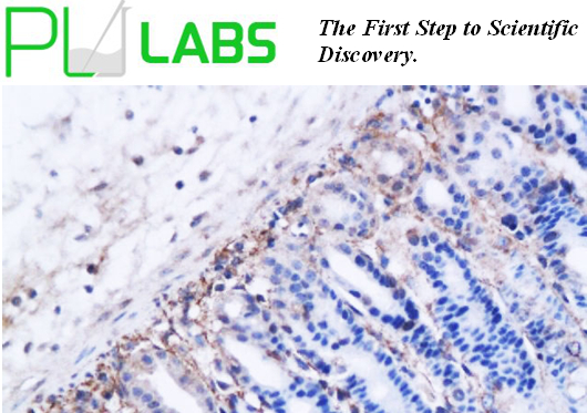 聚组氨酸抗体g标签抗体（C端）