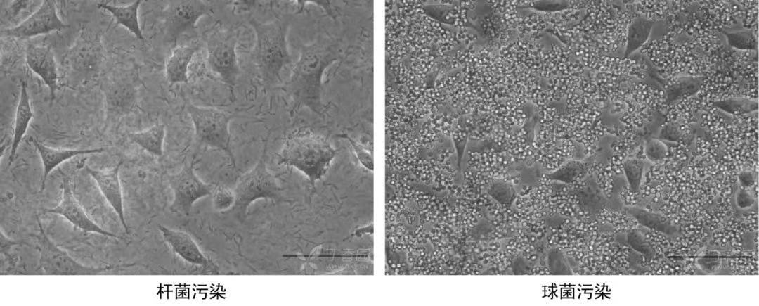 细胞又被污染了？一文教你如何预防及挽救