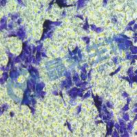 Transwell检测细胞侵袭