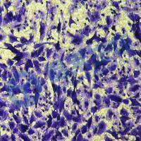 Transwell检测细胞迁移