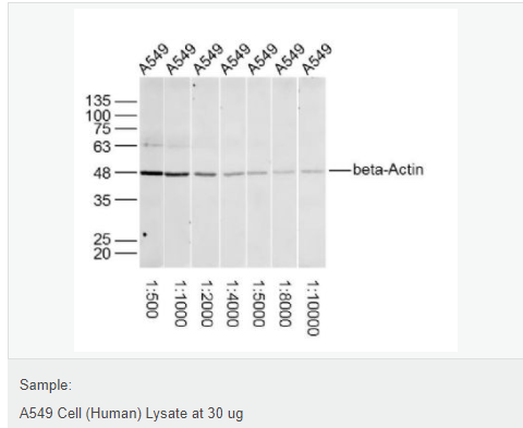 β-肌动蛋白/β-Actin（内参）抗体