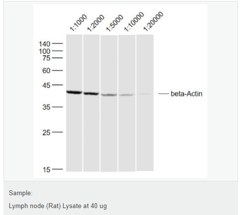 β-肌动蛋白/β-Actin（内参）抗体
