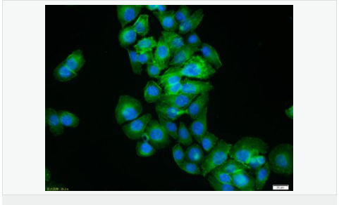 β-肌动蛋白/β-Actin（内参）抗体