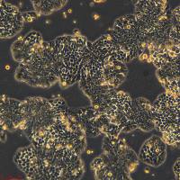 人结肠癌甲氨蝶呤耐药株 HT-29/MTX