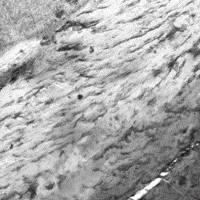 骨组织脱钙（小）