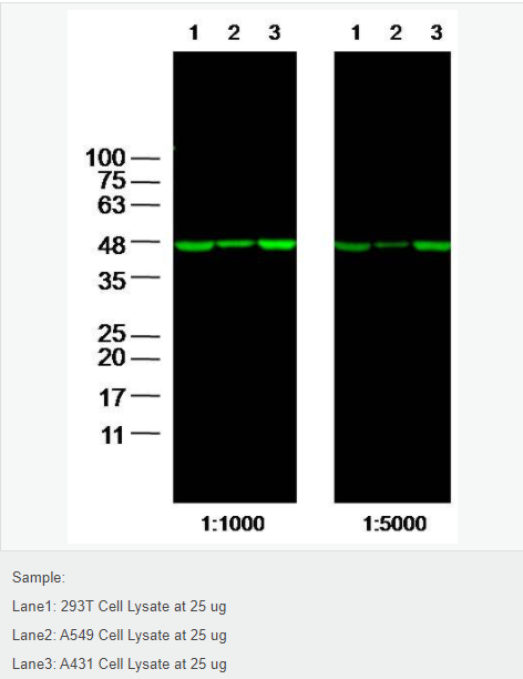 β-肌动蛋白/β-Actin（内参）抗体