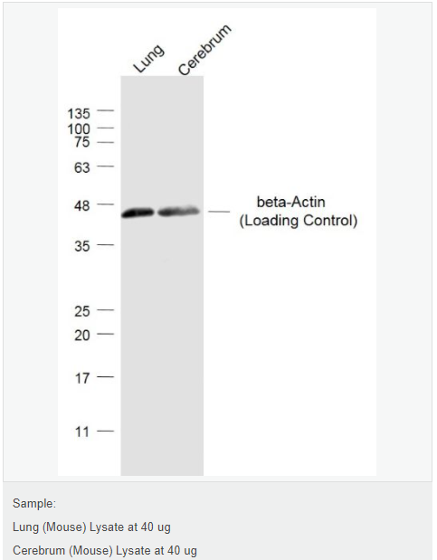 β-肌动蛋白/β-Actin（内参）抗体