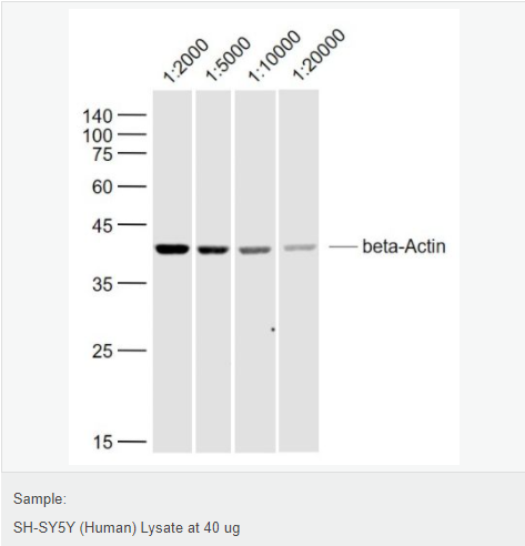 β-肌动蛋白/β-Actin（内参）抗体