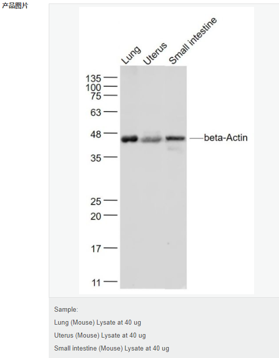 β-肌动蛋白/β-Actin（内参）抗体