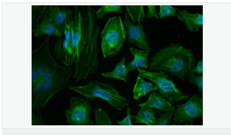 β-肌动蛋白/β-Actin（内参）抗体