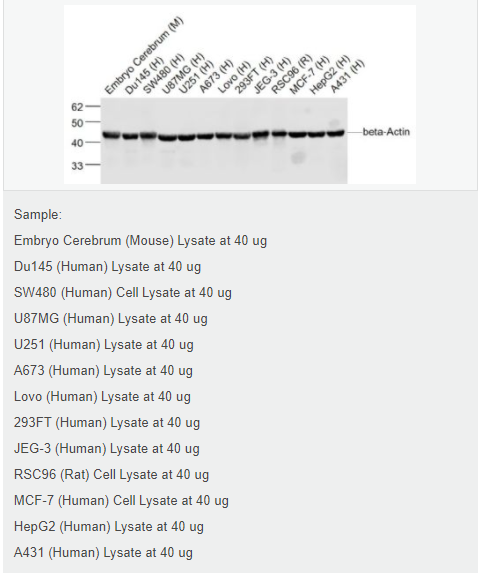 β-肌动蛋白/β-Actin（内参）抗体