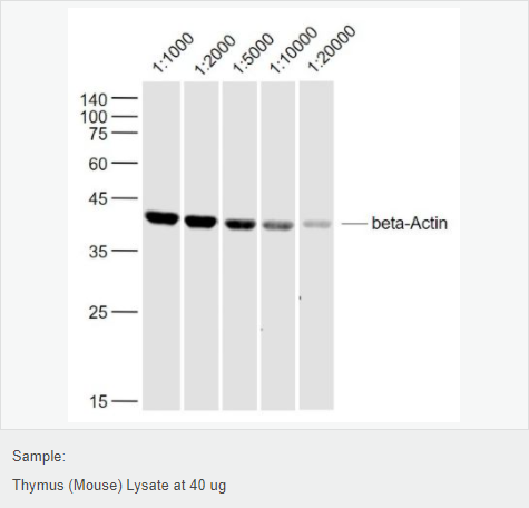 β-肌动蛋白/β-Actin（内参）抗体