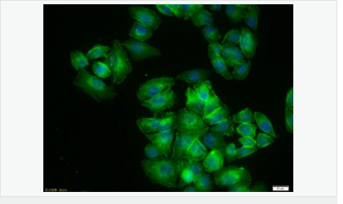β-肌动蛋白/β-Actin（内参）抗体