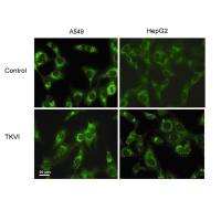免疫荧光验证自噬流