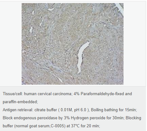 β-肌动蛋白/β-Actin（内参）抗体
