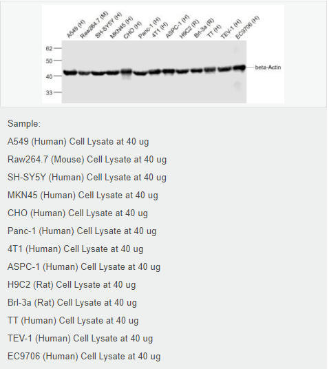 β-肌动蛋白/β-Actin（内参）抗体