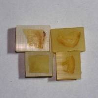 软化（肝硬化、皮肤结痂、植物等）